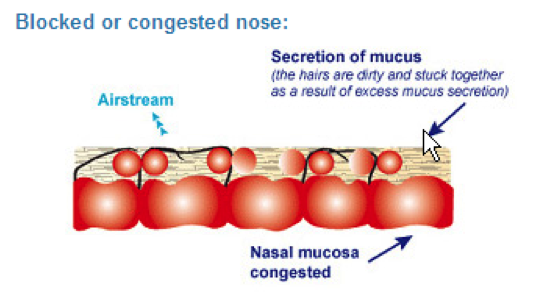 Diagram of a blocked nose showing cilia cells stuck down