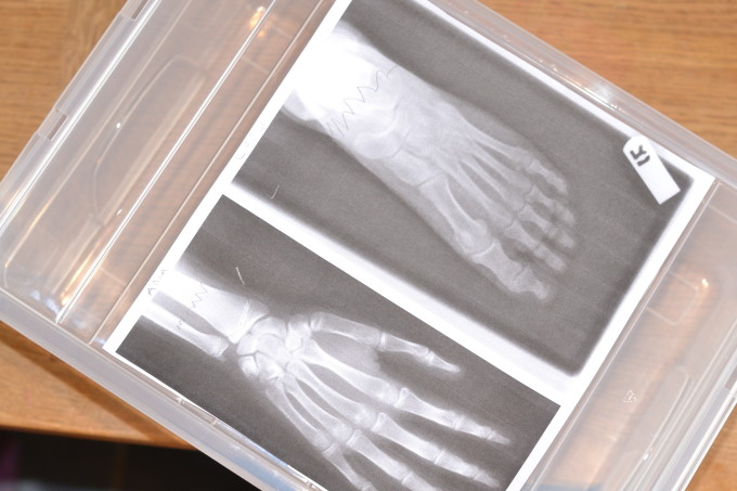 x-ray lightbox for role play