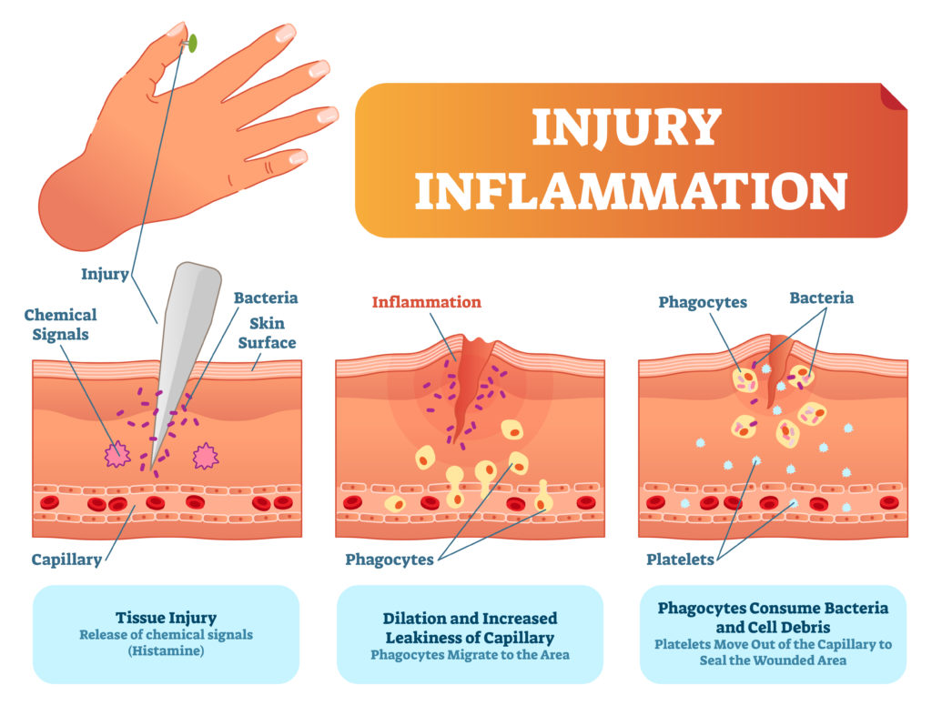 Immune response after injury - what is a scab