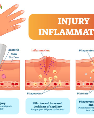 Immune response after injury - what is a scab