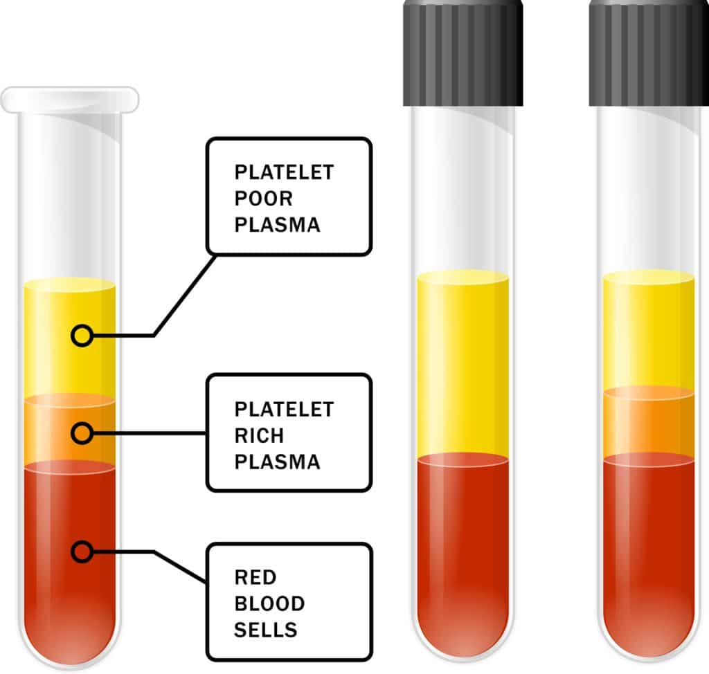 Blood after spinning in a centrifuge