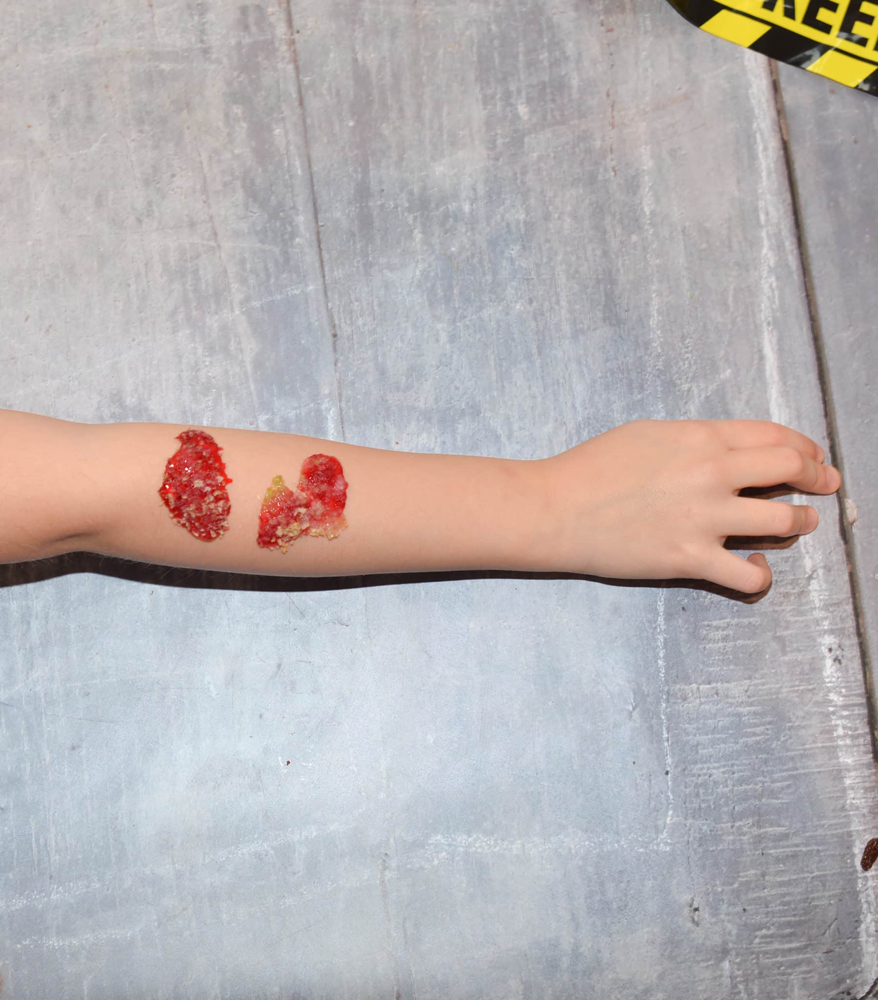 Jelly scab for learning about blood and blood clotting
