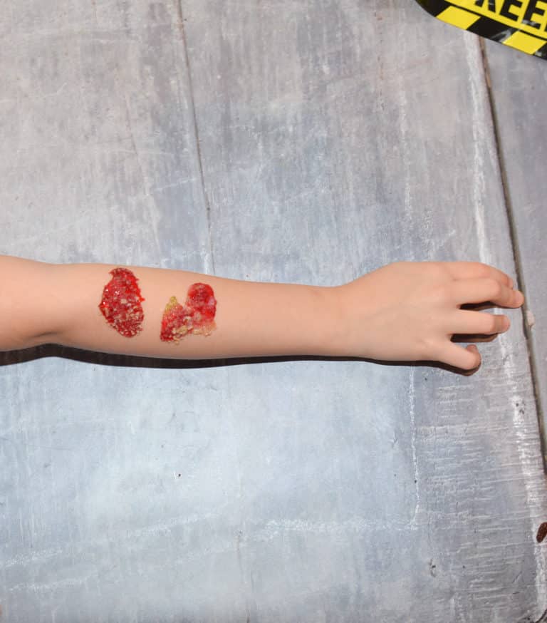 Jelly scab