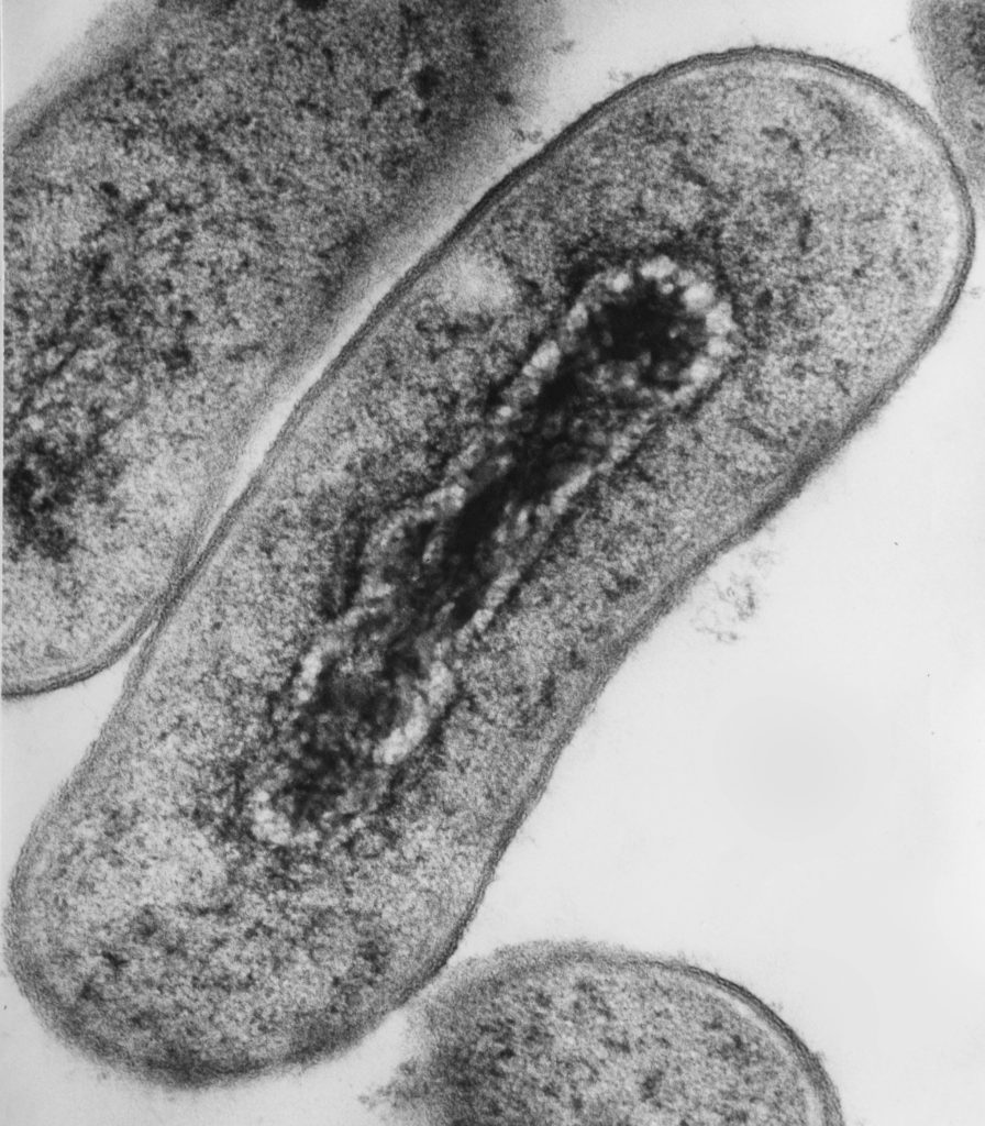 E. coli as seen under an electron microscope