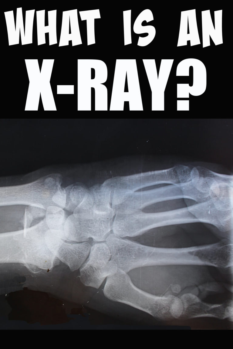 What is an XRay? Science Questions for kids