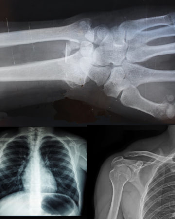 X- ray images