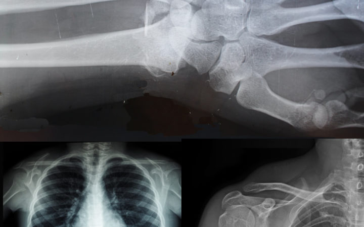 X- ray images
