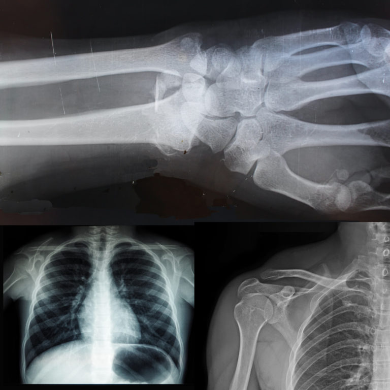 X- ray images