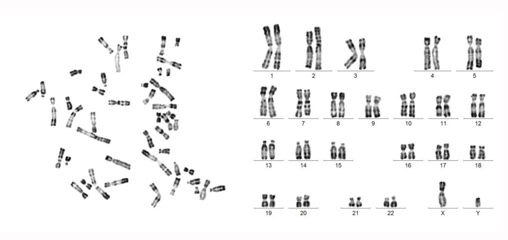 diagram showing the 23 pairs of chromosomes found in a normal cell.
