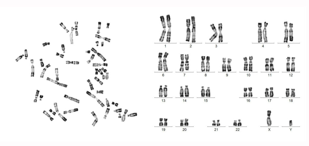 diagram showing the 23 pairs of chromosomes found in a normal cell. 