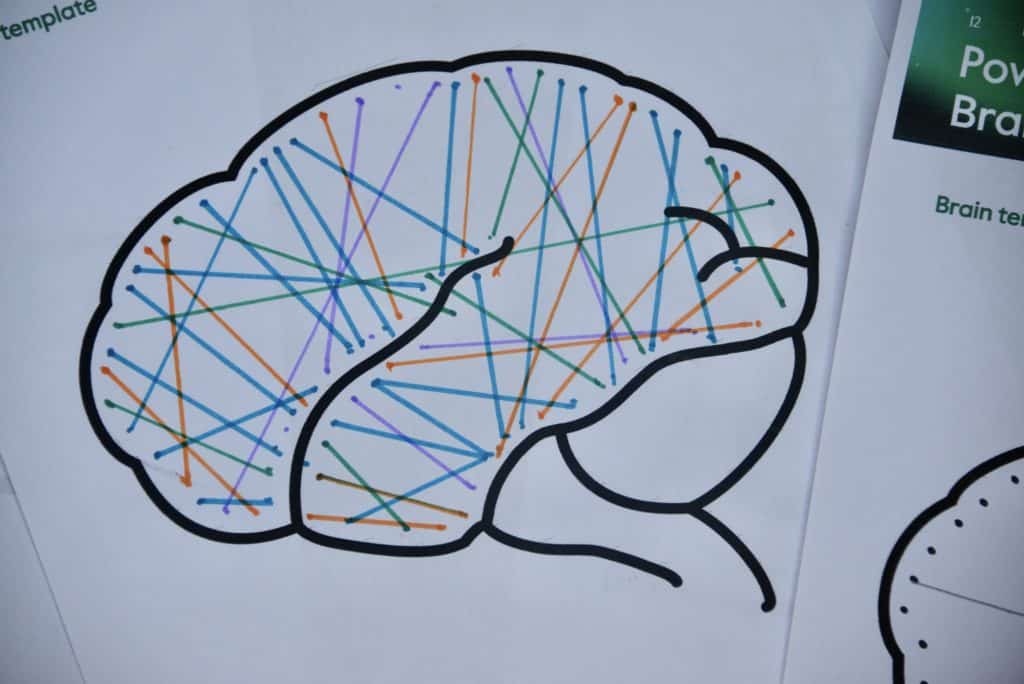 Brain Connectome with different coloured connections