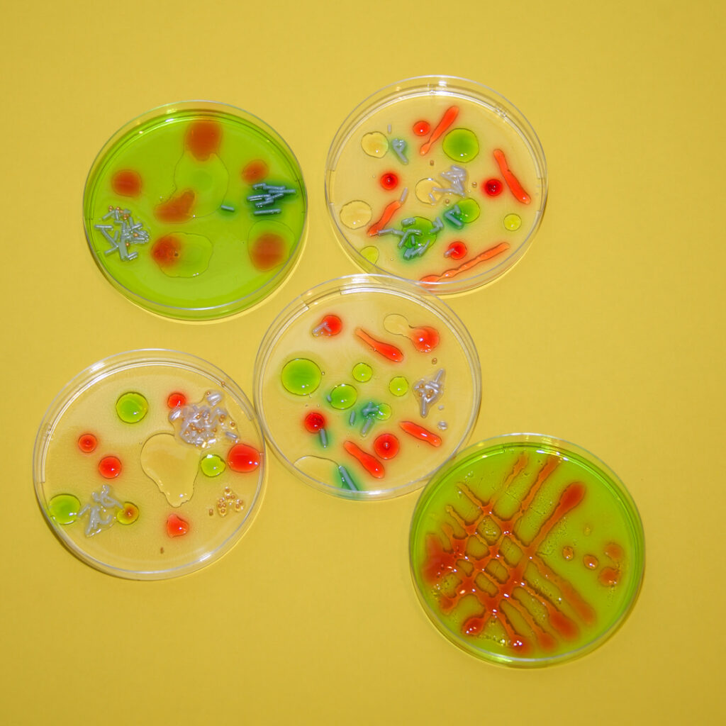 Jello petri dish bacteria Halloween party food
