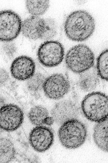 Transmission electron micrograph of Sin Nombre virus. Transmission electron micrograph of Sin Nombre virus. Hantavirus.